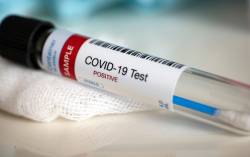 Viitorul anunta doua cazuri de coronavirus la prima echipa